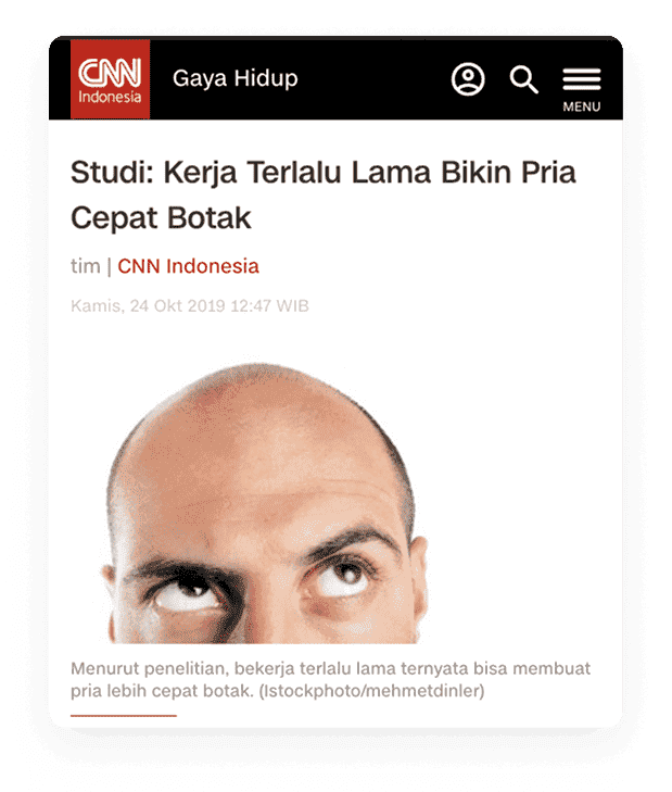 Berita kebotakan pria